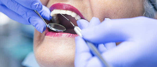 Best Emergency Treatment for Toothache in West Lawn, PA
